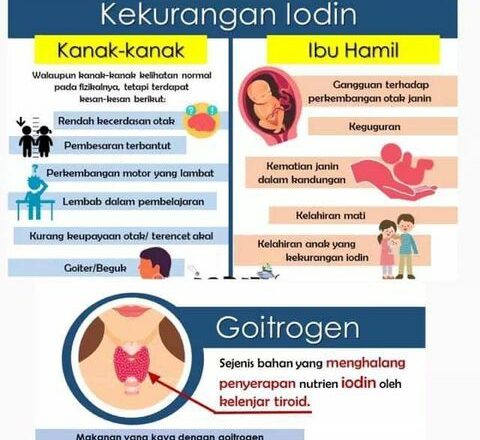 Iodin Merupakan Bahan Mineral Yang Terdapat Dalam Makanan_642b0a45457a4.jpeg