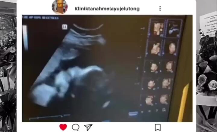 Jom Scan Dengan Klinik Tanah Melayu Jelutong Untuk_642b09c9f14c3.jpeg