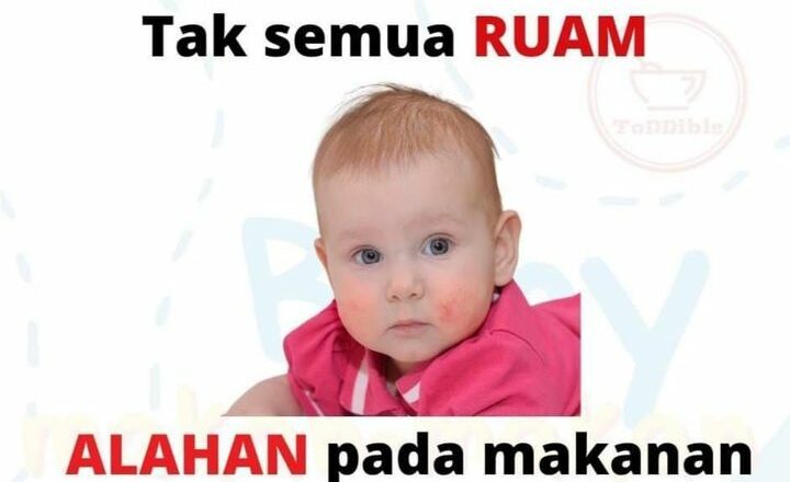 Ramai Ibu Ibu Ingat Bila Ruam Sahaja Adalah_642b0a65361b6.jpeg