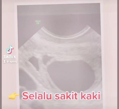 Rm 600 Sahaja Tau Rawatan Vaginal Tightening!_642b092fb6b06.jpeg