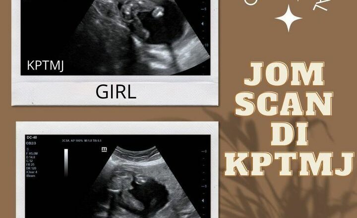 Assalamualaikum Selamat Malam Untuk Sesi Ultrasound Esok Sabtu_64529acef149e.jpeg